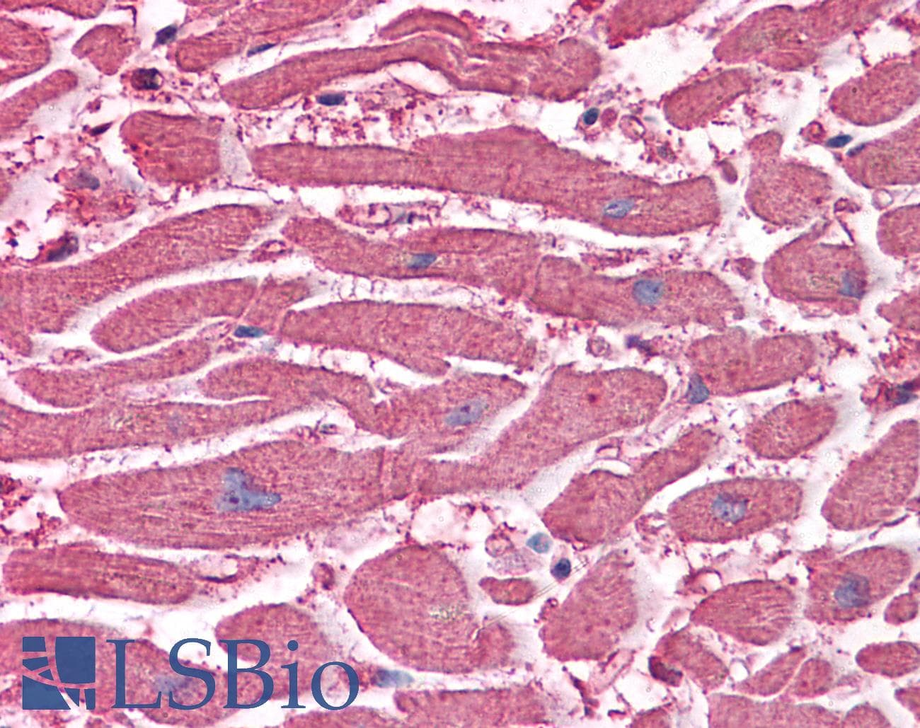 IHC-plus™ EDEM2 Antibody (clone 2E4)