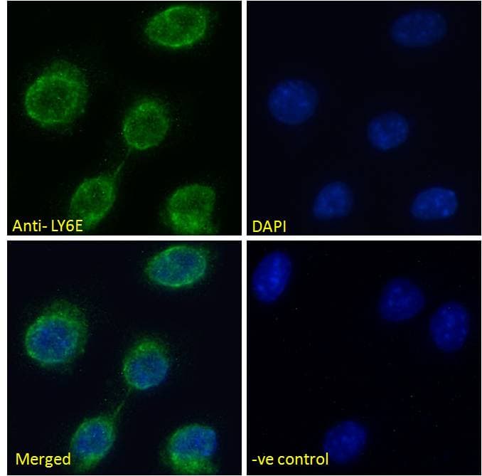 SCA2 / LY6E Antibody (aa46-56)