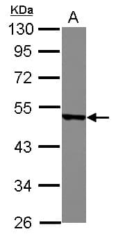 IHC-plus™ MSY2 / YBX2 Antibody (Internal)