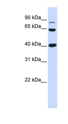 CTNNB1 / Beta Catenin Antibody (aa684-733)