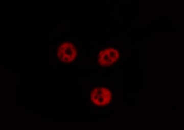 AKAP8 / AKAP95 Antibody