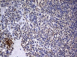 Monoclonal Mouse anti-Human BCL10 / BCL-10 Antibody (clone OTI4G4, IHC, WB)