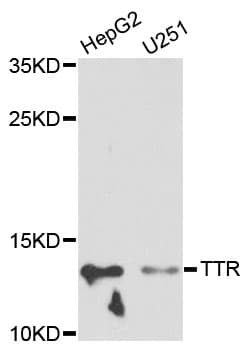 IHC-plus™ TTR / Transthyretin Antibody
