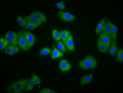 SLC4A5 / NBC4 Antibody