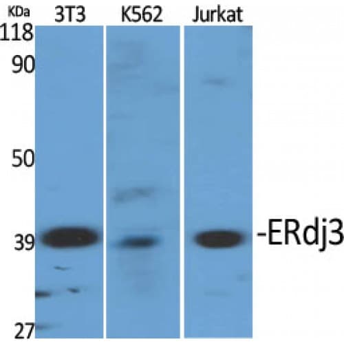 Polyclonal Rabbit anti-Human DNAJB11 Antibody (1-80 aa, Internal, IHC, WB)