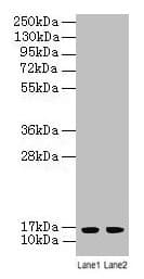 Polyclonal Rabbit anti-Human LSM4 Antibody (aa1-139, IHC, WB)