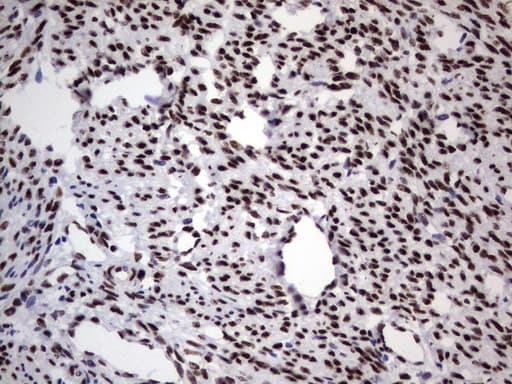 Monoclonal Mouse anti-Human DDX56 Antibody (clone UMAB152, Carrier-free, aa323-547, IHC, IF, WB)