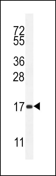SPACA5 Antibody (aa40-69)