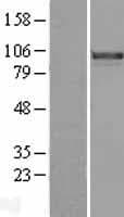 FOXM1 Protein (Over-Expression Lysate Myc-DDK (Flag))
