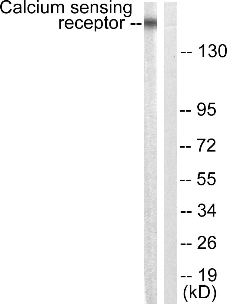 CASR/Calcium Sensing Receptor Antibody (aa854-903)