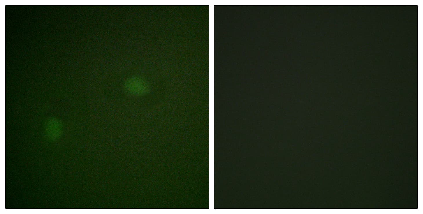IHC-plus™ Polyclonal Rabbit anti-Human NPM1 / NPM / Nucleophosmin Antibody (aa201-250, IHC, IF, WB)