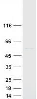 Human Cytochrome P450 2R1 / CYP2R1 Protein (Recombinant Myc-DDK (Flag))