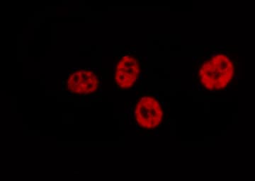 JUN / c-Jun Antibody (phospho-Ser73)
