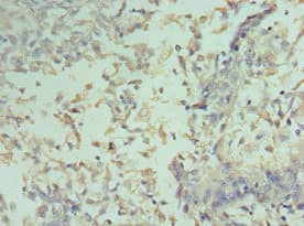 CCND2 / Cyclin D2 Antibody (aa1-289)