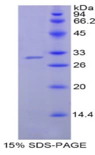Human NNMT Protein (Recombinant His)