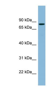 Polyclonal Rabbit anti-Human Band 4.1 / EPB41 Antibody (aa107-156, WB)