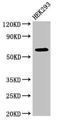 Polyclonal Rabbit anti-Human DEPDC1B Antibody (IHC, IF, WB)