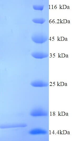 Mouse FXN / Frataxin Protein (Recombinant 6His, N-terminus)
