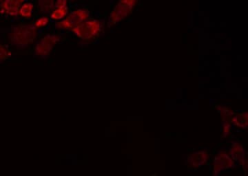 JAKMIP2 Antibody