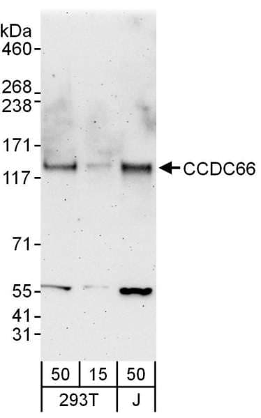 Polyclonal Rabbit anti-Human CCDC66 Antibody (aa898-948, WB)
