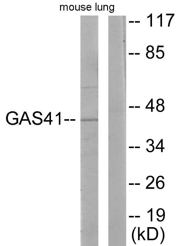 GAS41 Antibody (aa1-50)