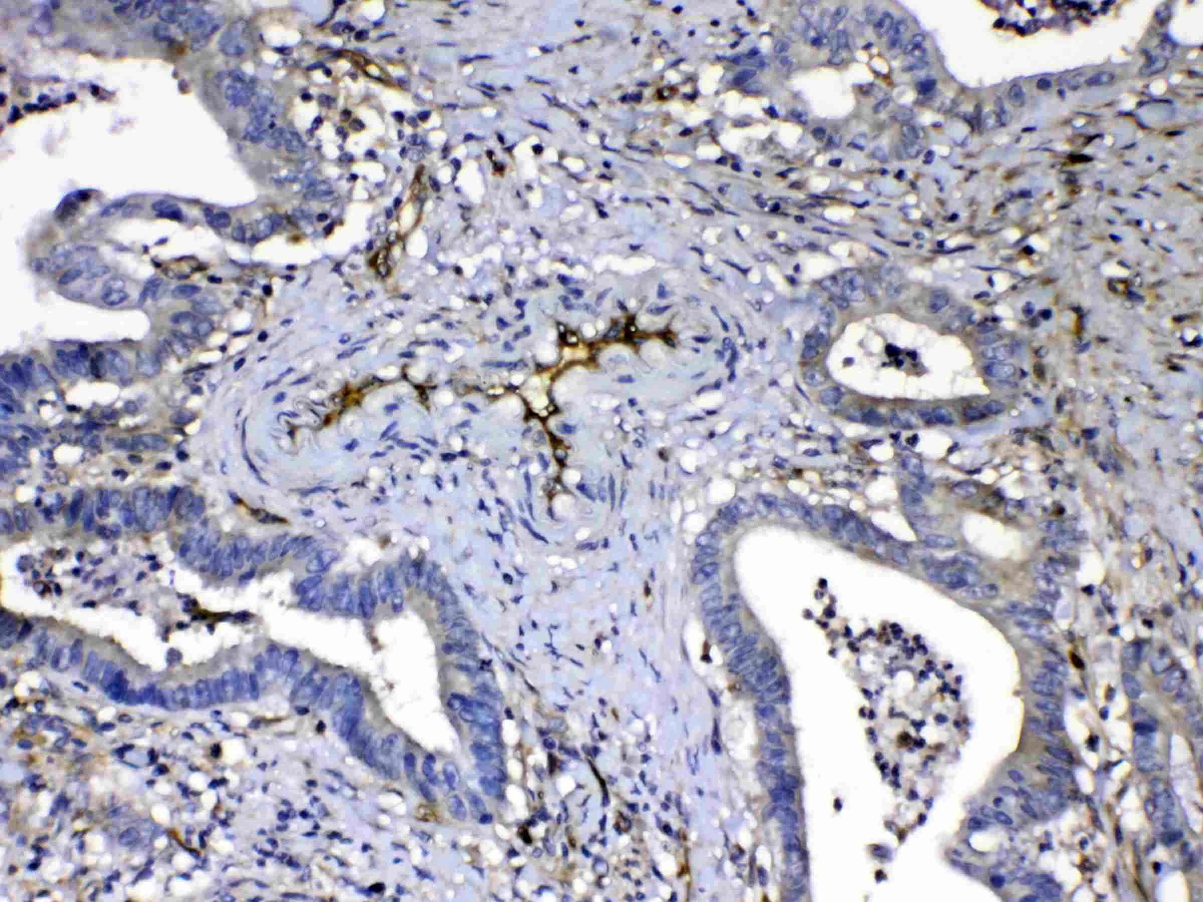 HOMER3 / Homer 3 Antibody