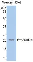GALC / Galactocerebrosidase Antibody (aa375-535)