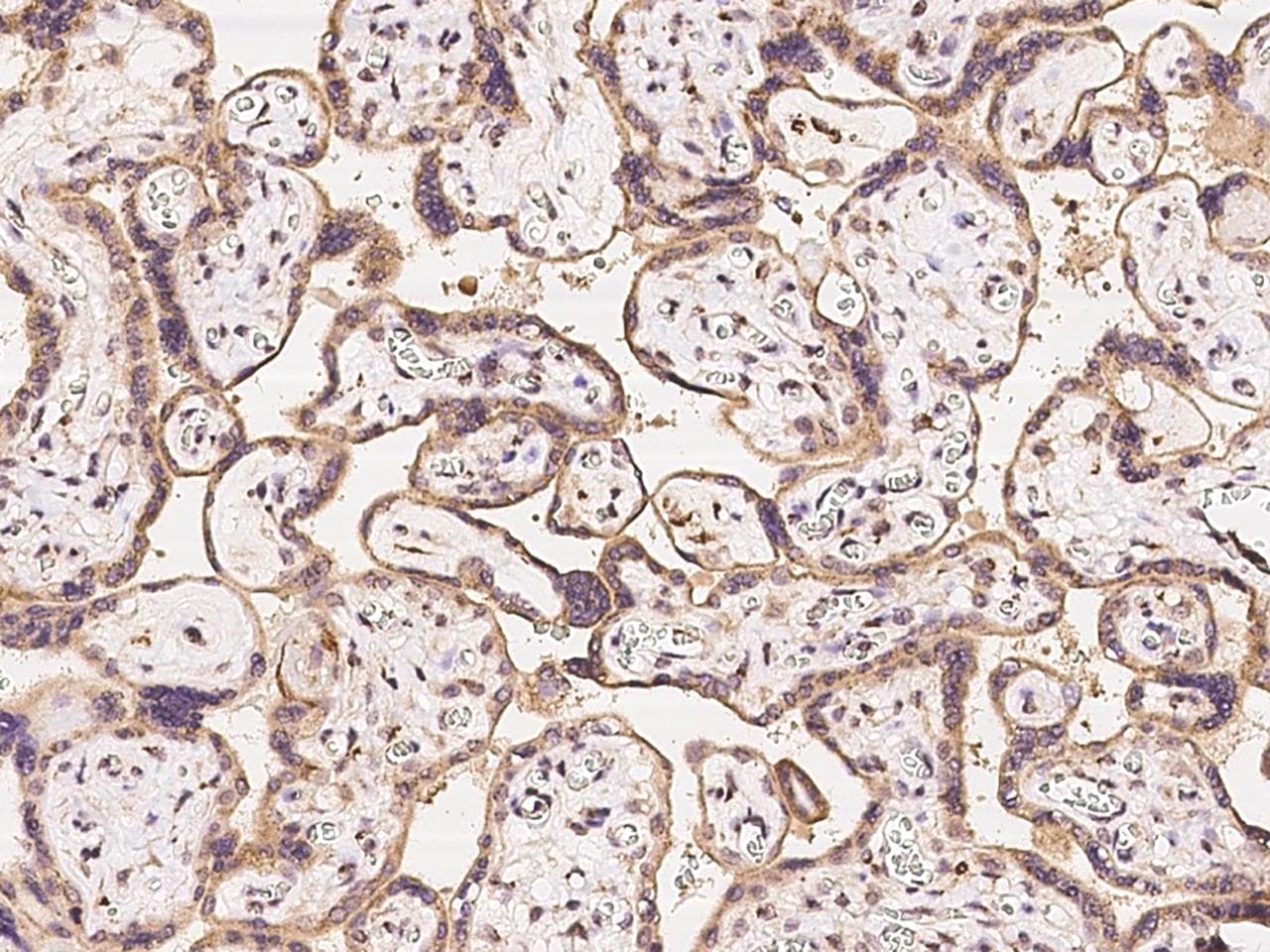 IGF2R / CD222 Antibody
