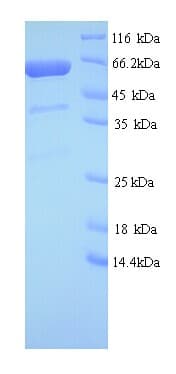 Human GIGYF2 Protein (Recombinant His)