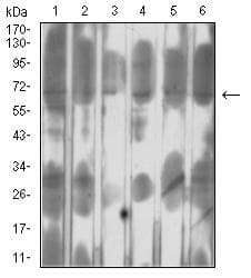 SETD7 / SET7 Antibody (clone 3D6G11)