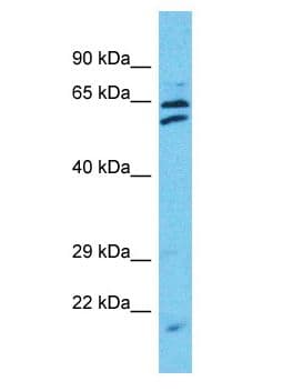 TTC24 Antibody (aa449-498)