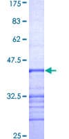 Human RPGR Protein (Recombinant GST, N-terminus)