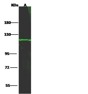 HK1 / Hexokinase 1 Antibody (Preservative Free)