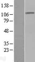 DIS3 Protein (Over-Expression Lysate Myc-DDK (Flag))