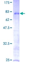 Human ZNF70 Protein (Recombinant GST)