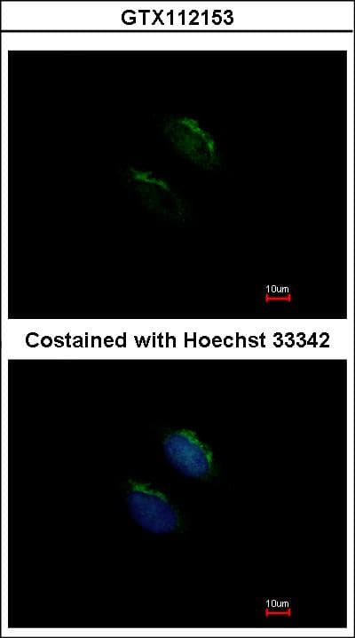GNT-III / MGAT3 Antibody (aa260-525)