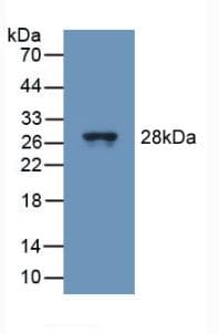 TUBD1 / Tubulin Delta Antibody (aa236-455, APC)