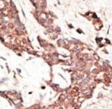 SIRT3 / Sirtuin 3 Antibody (aa250-279)