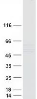 Human KRT24 / Keratin 24 Protein (Recombinant Myc-DDK (Flag))