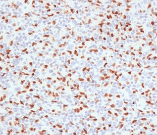 SPI1 / PU.1 Antibody (clone TFPU1-1)