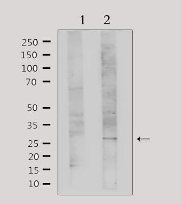 Polyclonal Rabbit anti-Human LGALS3 / Galectin 3 Antibody (IHC, IF, WB)