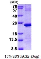 Human IMP3 Protein (Recombinant His)