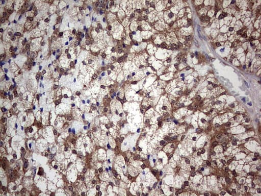 PIK3CA / PI3K Alpha Antibody (aa303-631, clone OTI6D1)