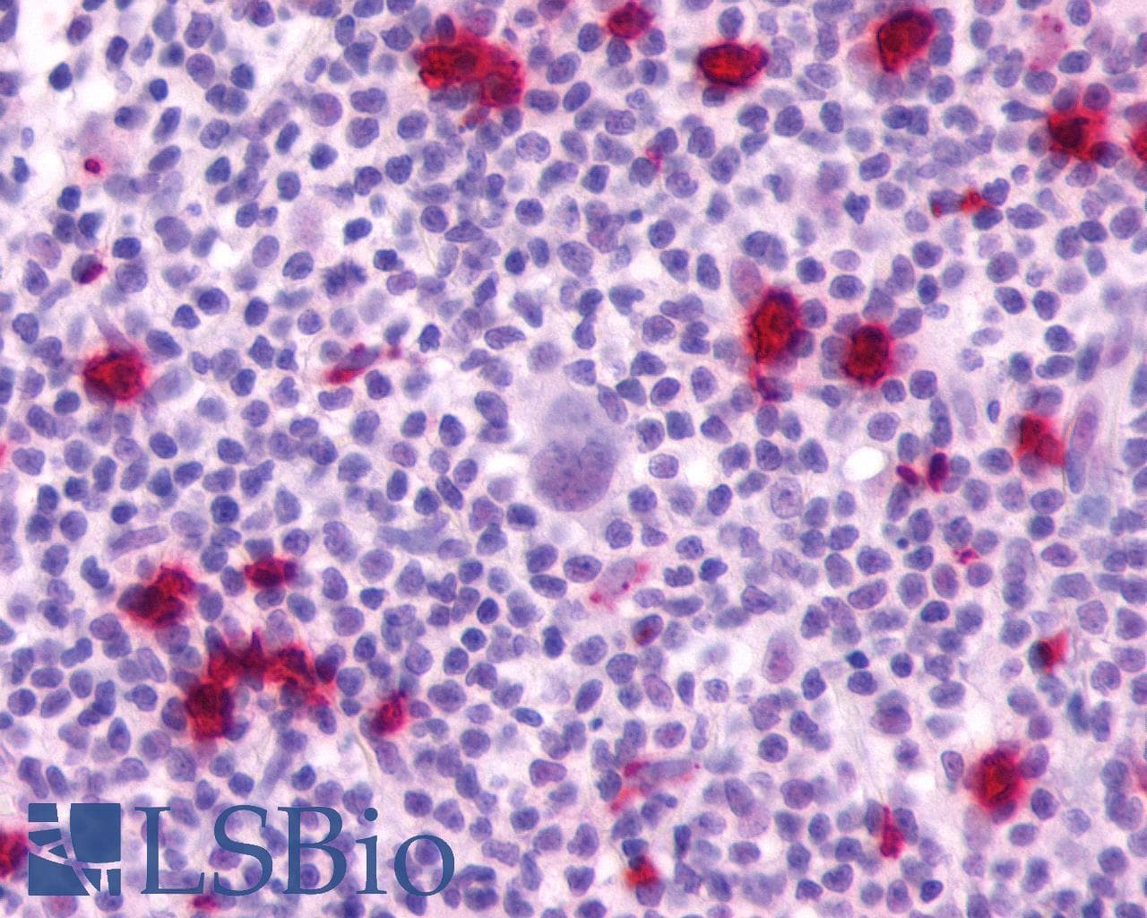 IHC-plus™ P2RY4 / P2Y4 Antibody (Extracellular Domain)