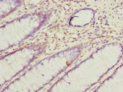 Polyclonal Rabbit anti-Human VAT1L Antibody (IHC, WB)