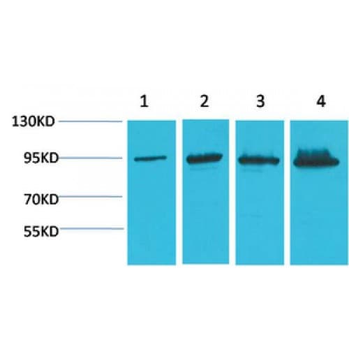 CTNNB1 / Beta Catenin Antibody (clone 4F2)