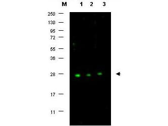 Polyclonal Rabbit anti-Human CDKN1B / p27 Kip1 Antibody (WB)
