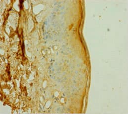 DOK1 Antibody