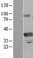 PRMT6 Protein (Over-Expression Lysate Myc-DDK (Flag))
