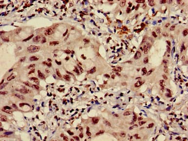 Polyclonal Rabbit anti-Human HIST1H3A Antibody (IHC, IF, WB)
